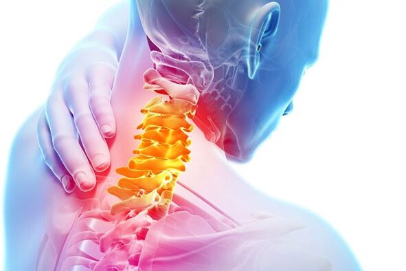 Le cause dell'osteocondosi cervicale